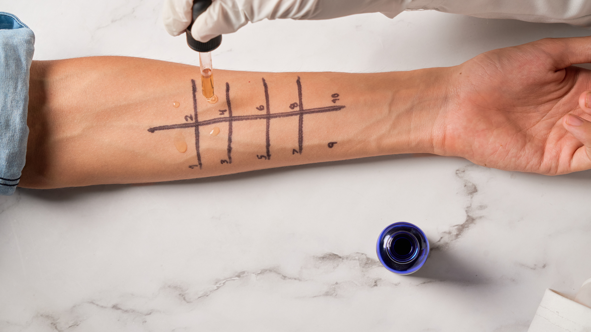 BAT xét nghiệm dị ứng thuốc đóng vai trò như một công cụ sàng lọc hỗ trợ