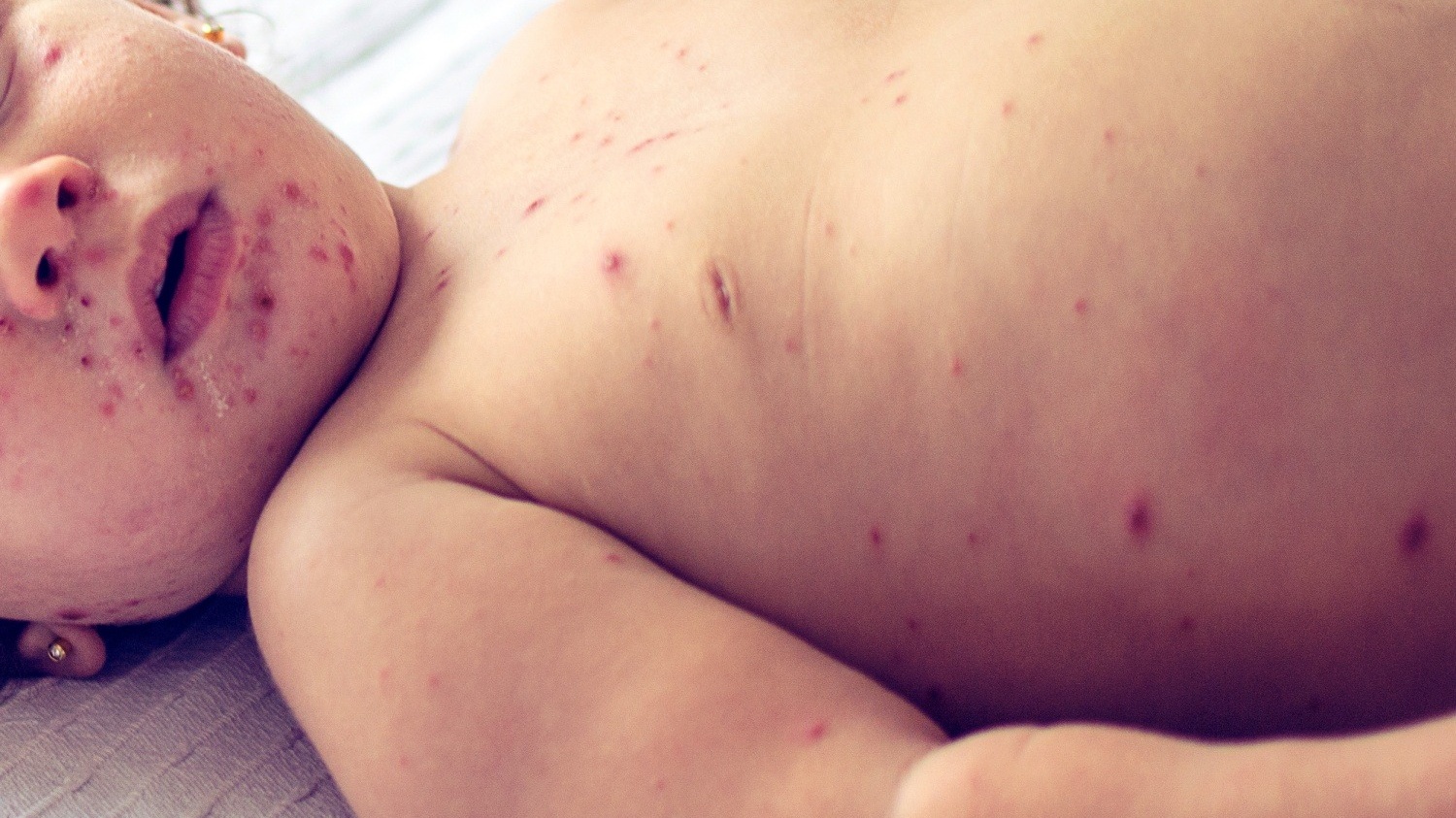 be-10-thang-tiem-soi-duoc-khong-giai-dap-tu-chuyen-gia-1 Cropped.jpg