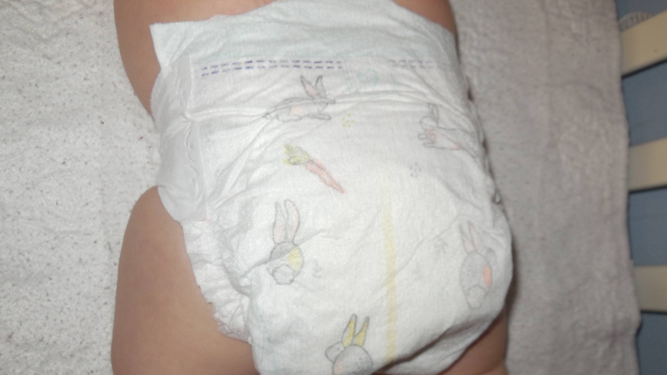 Bé bị hăm tã nặng có thể do mặc tã liên tục, da vùng kín bị bí, không thoát mồ hôi và luôn ẩm ướt