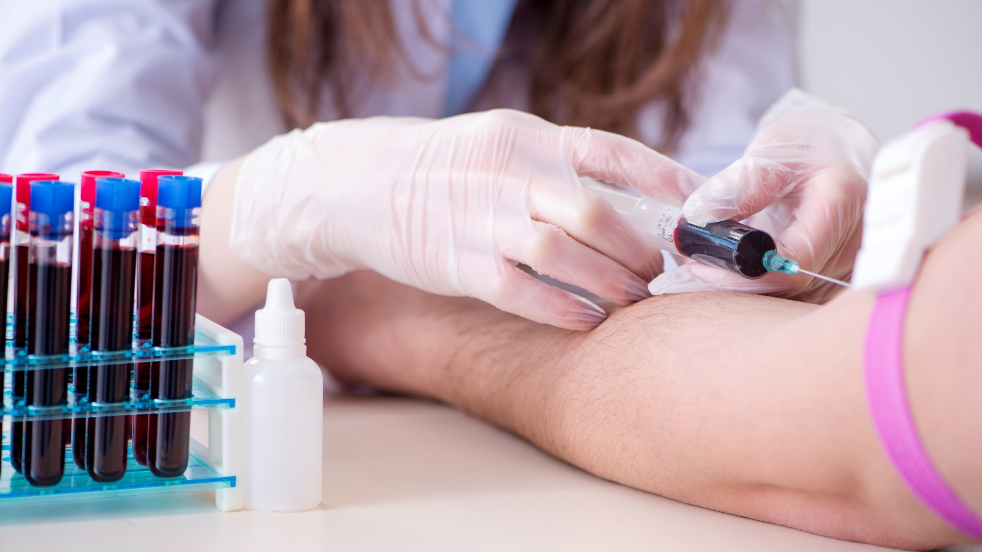 Nếu người bệnh có biểu hiện sốt, ớn lạnh, mệt mỏi hoặc nghi ngờ nhiễm trùng toàn thân, bác sĩ có thể chỉ định các xét nghiệm máu