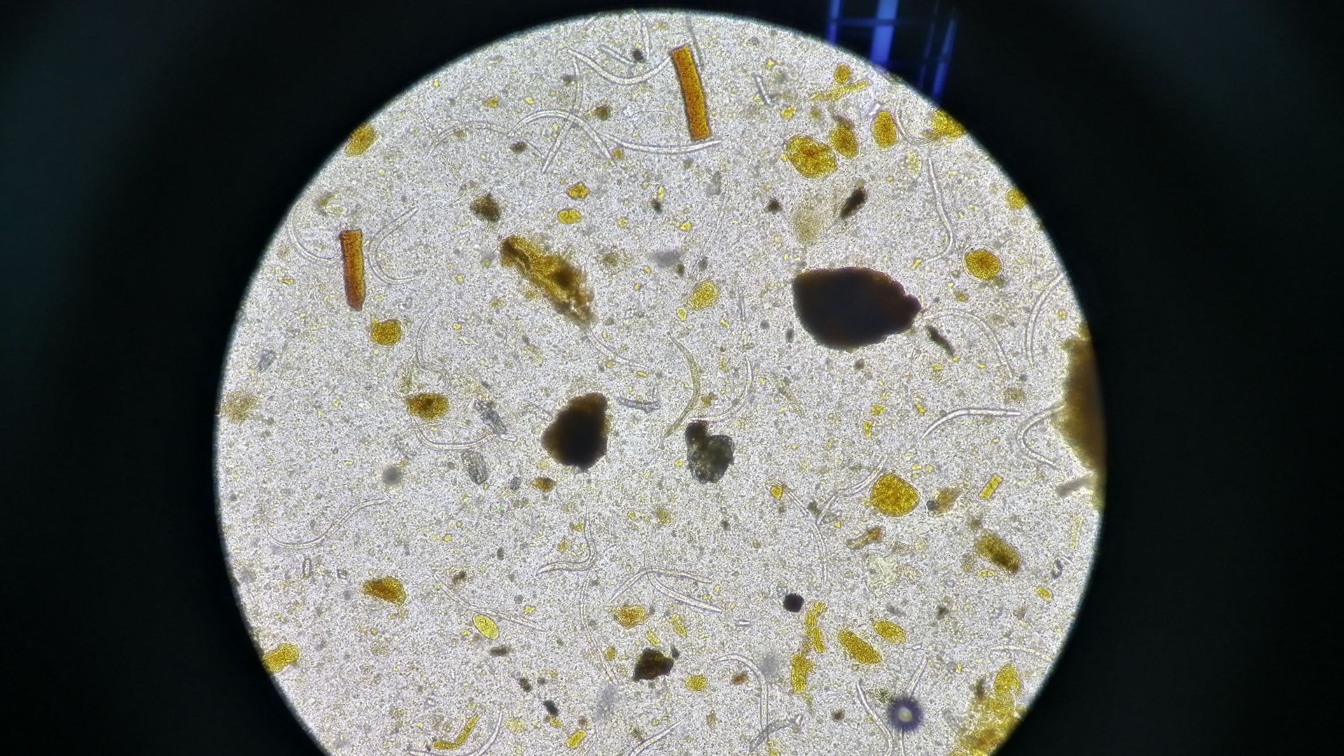 Bệnh có thể gây ra bởi nhiễm ký sinh trùng, nhưng phần lớn nang gan là lành tính và không rõ nguyên nhân