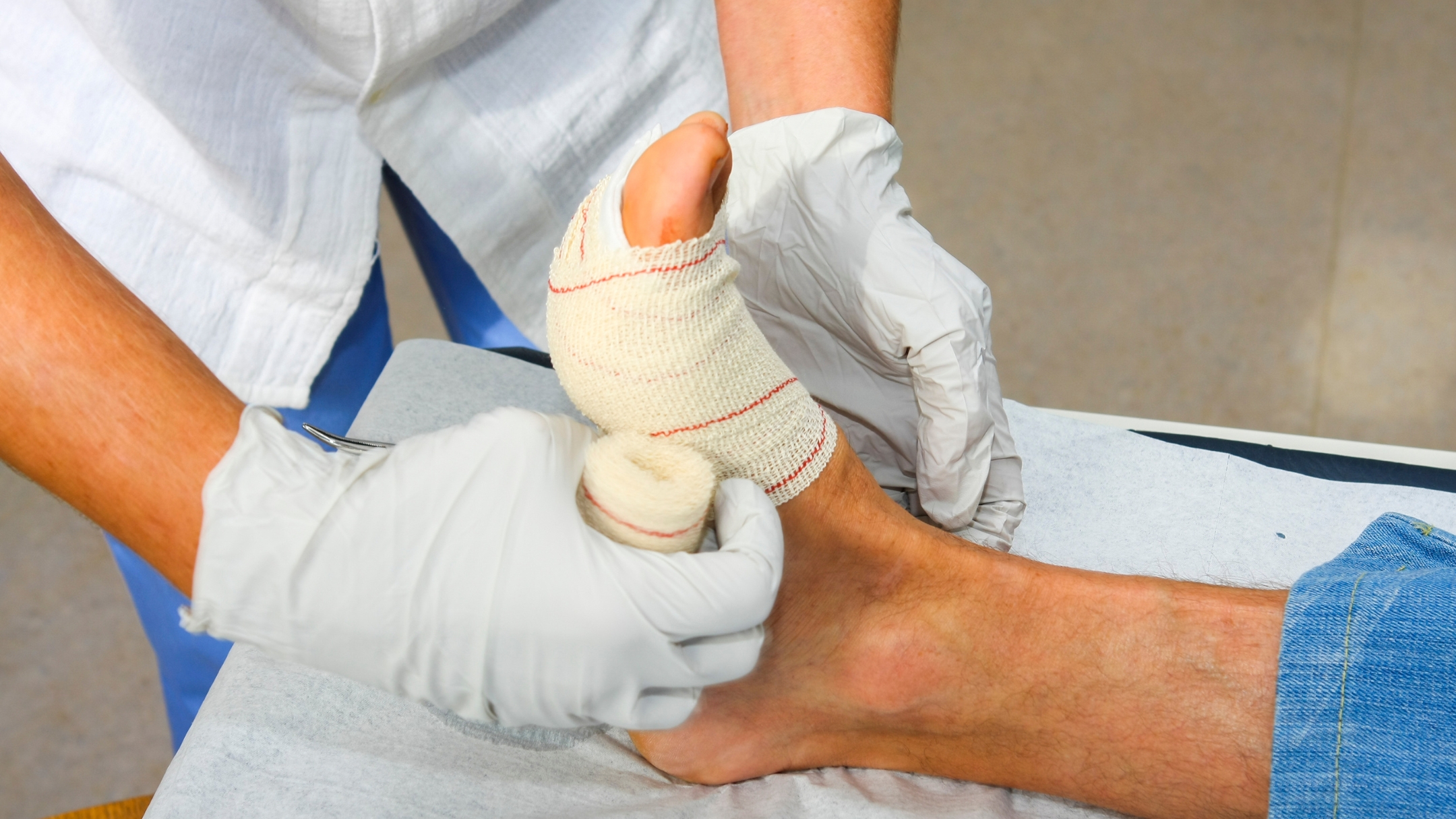 Sơ cứu là bước quan trọng giúp hạn chế tổn thương tiến triển và hỗ trợ quá trình điều trị sau đó