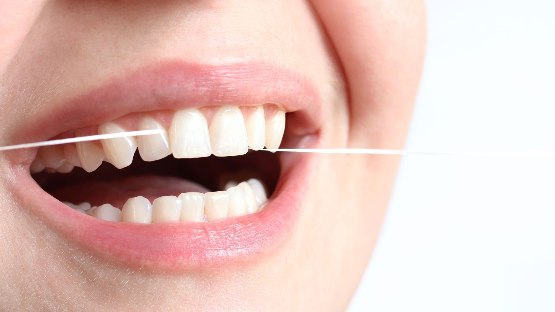 Vệ sinh răng miệng bằng chỉ nha khoa để làm sạch kẽ răng