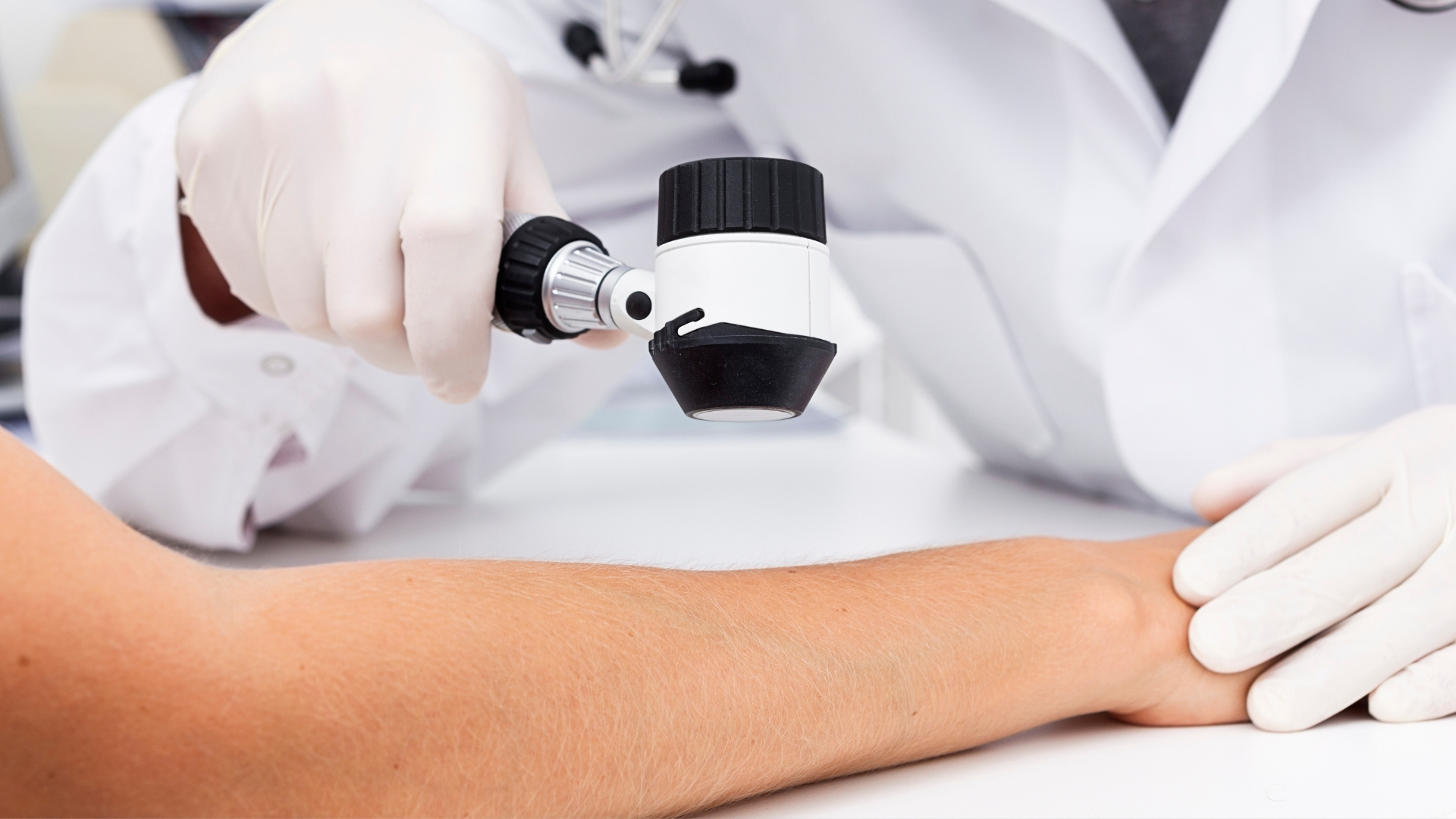 Dermoscopy giúp quan sát rõ hình thái của chấy hoặc trứng