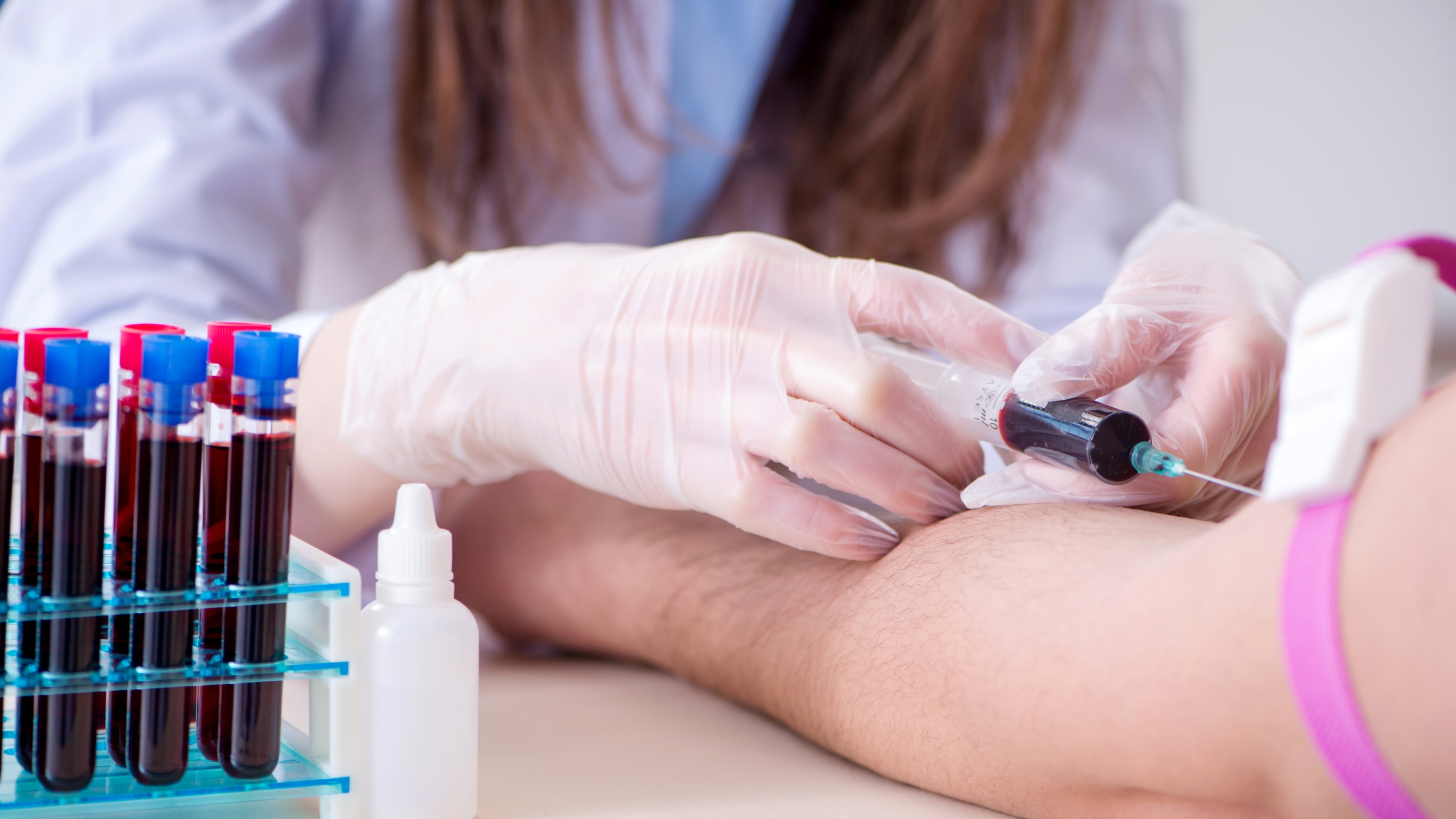 Xét nghiệm máu có thể được chỉ định nhằm tìm kiếm các dấu hiệu của bệnh lý viêm khớp hoặc bệnh tự miễn