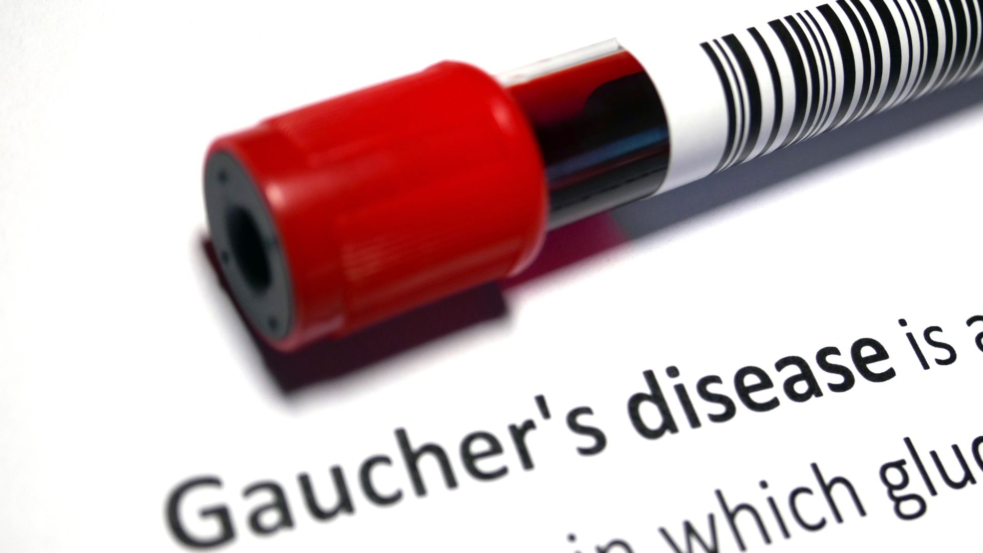 Định lượng hoạt tính enzym β-glucocerebrosidase là tiêu chuẩn chẩn đoán xác định