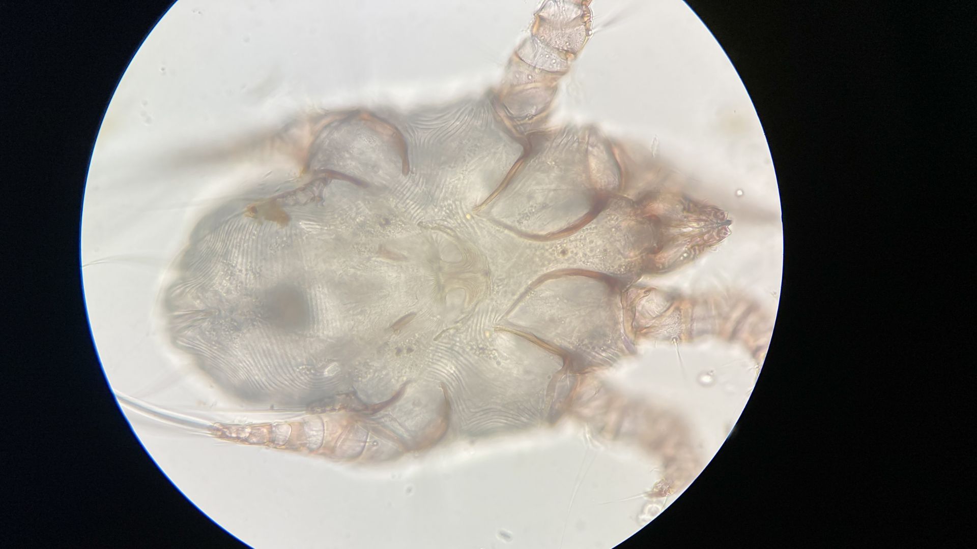 Nguyên nhân trực tiếp gây bệnh ghẻ là do ký sinh trùng&nbsp;Sarcoptes scabiei hominis