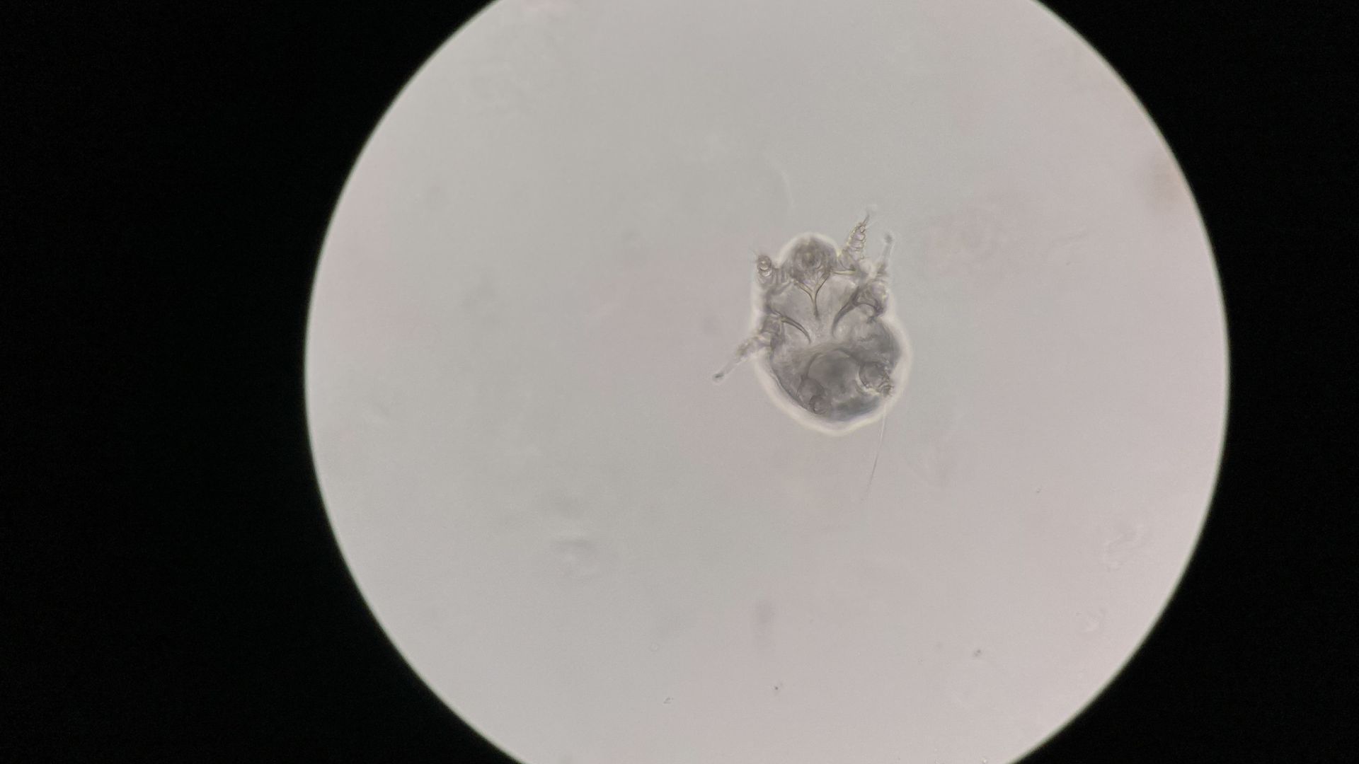 Ký sinh trùng ghẻ Sarcoptes scabiei hominis