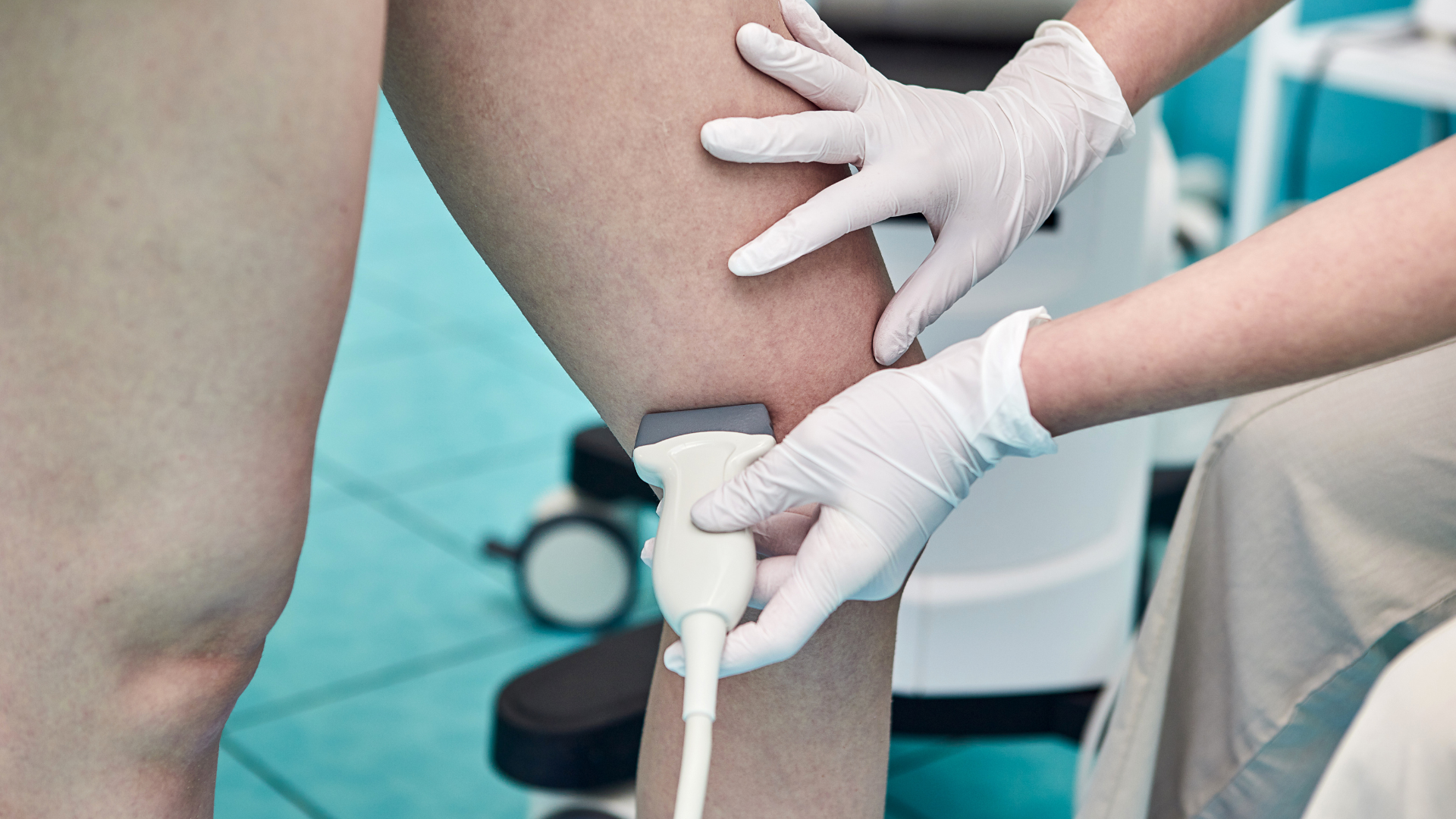 Siêu âm Doppler tĩnh mạch chi dưới cực kỳ quan trọng trong chẩn đoán huyết khối tĩnh mạch sâu