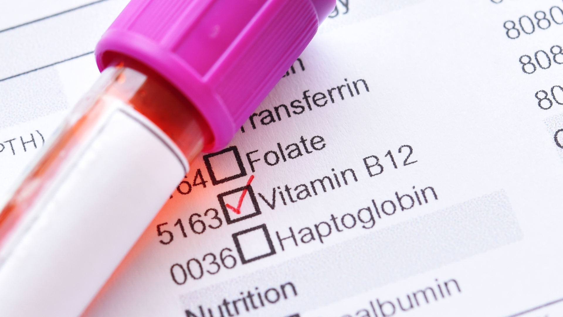 Định lượng vitamin B12 có thể được chỉ định trong trường hợp nghi ngờ thiếu vi chất