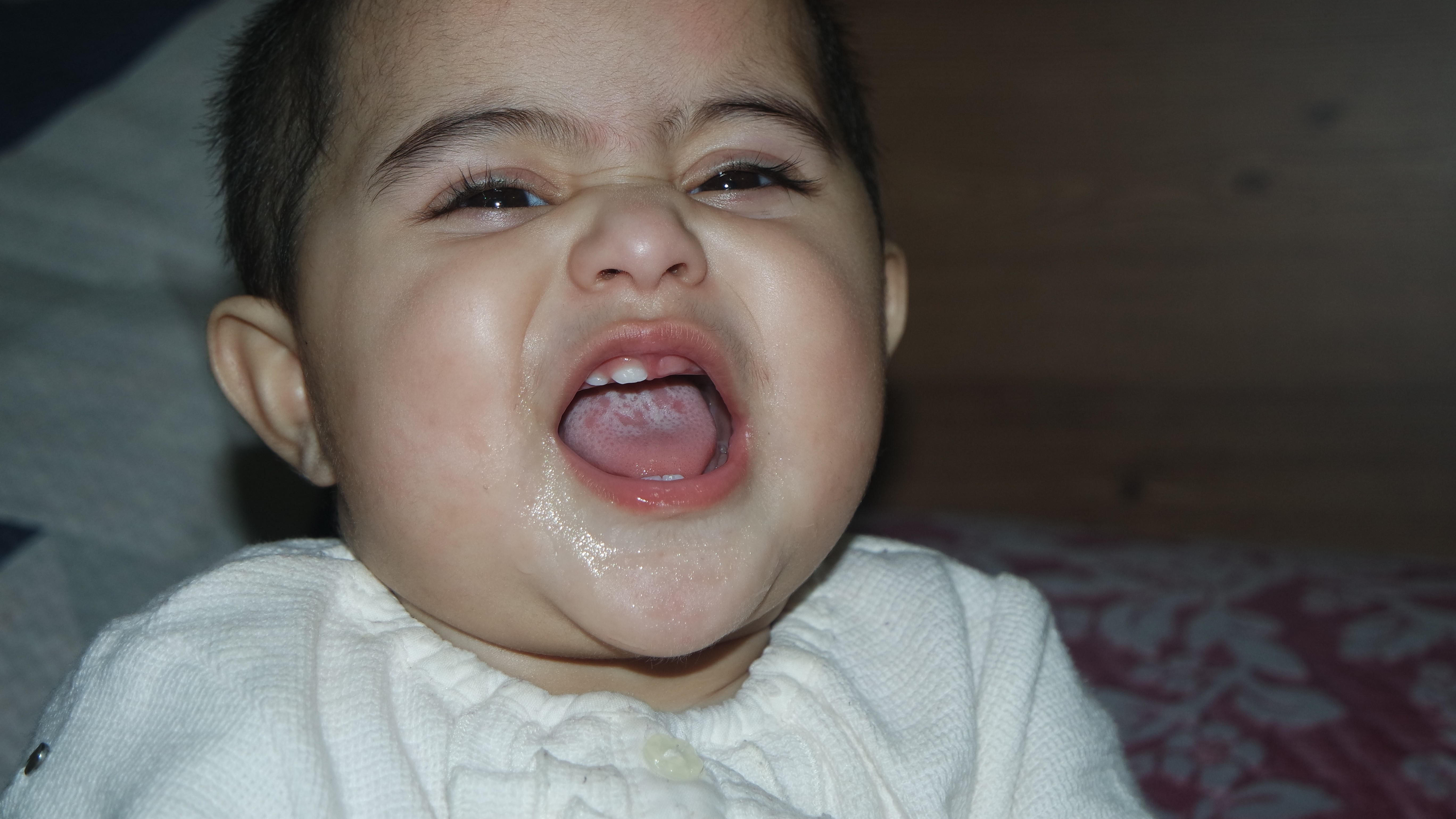 Nấm miệng biểu hiện là các mảng trắng hình thành trong miệng