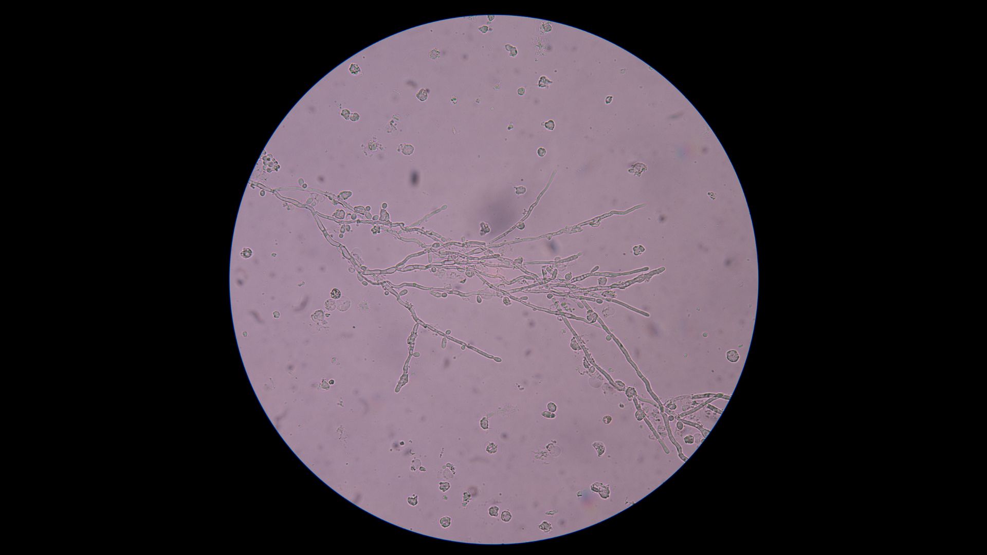 Trichophyton rubrum là một trong những tác nhân phổ biến gây nấm móng
