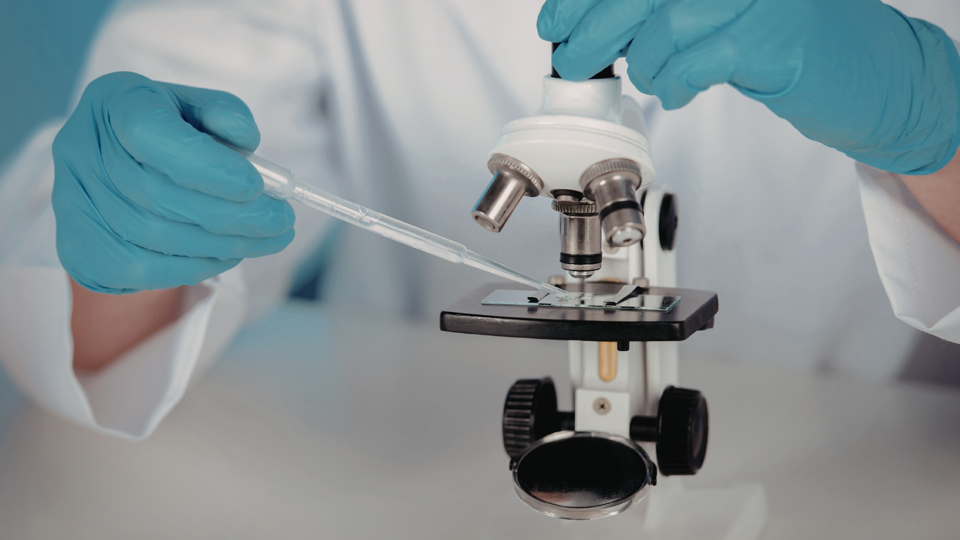 Soi kính hiển vi là phương pháp xét nghiệm nhanh chóng, hiệu quả để chẩn đoán nấm móng