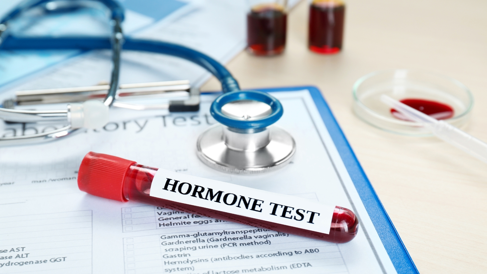 Bác sĩ có thể chỉ định xét nghiệm máu để kiểm tra các hormone liên quan như estrogen