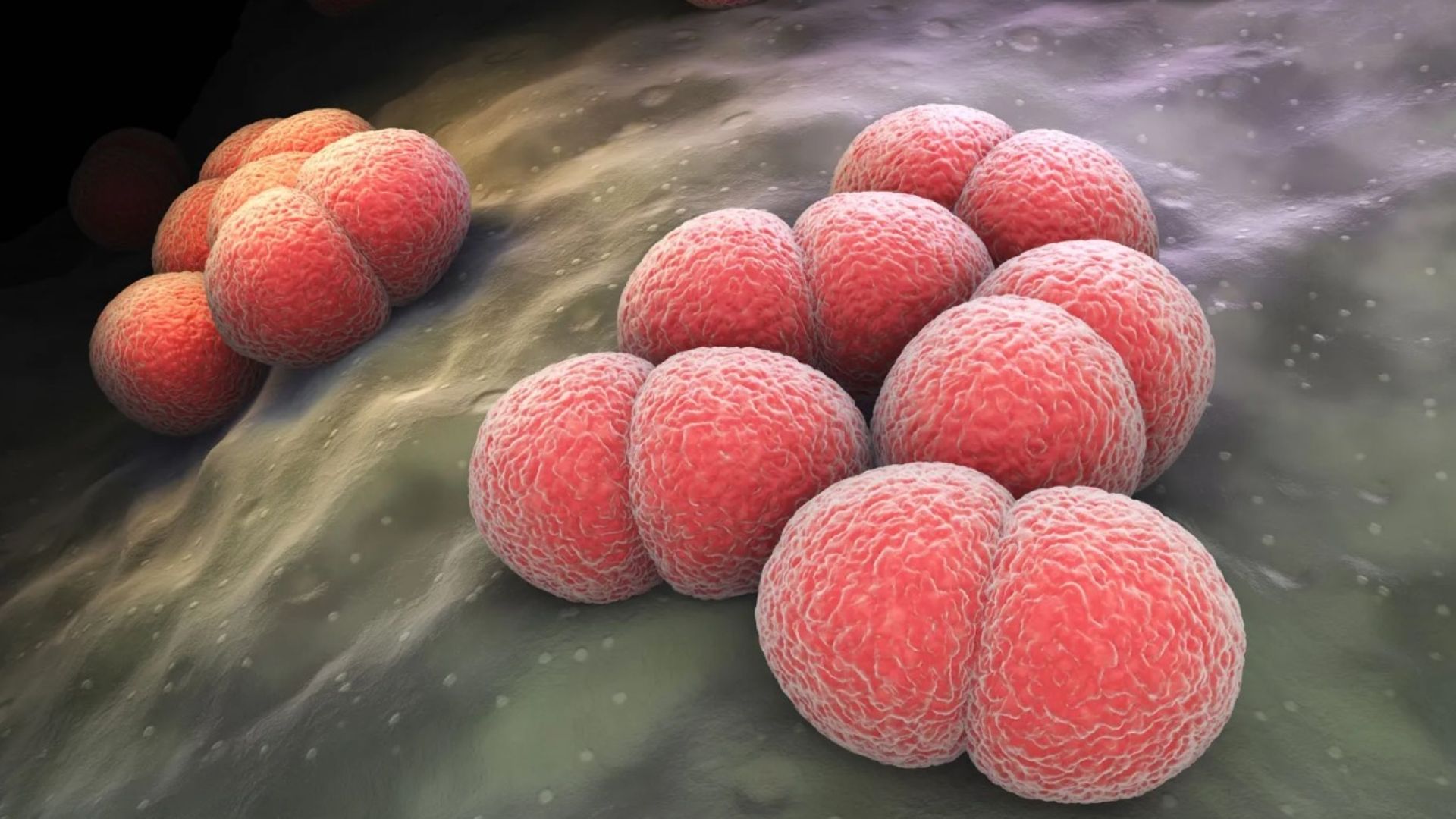 Vi khuẩn Neisseria meningitidis là nguyên nhân dẫn đến nhiễm khuẩn huyết não mô cầu