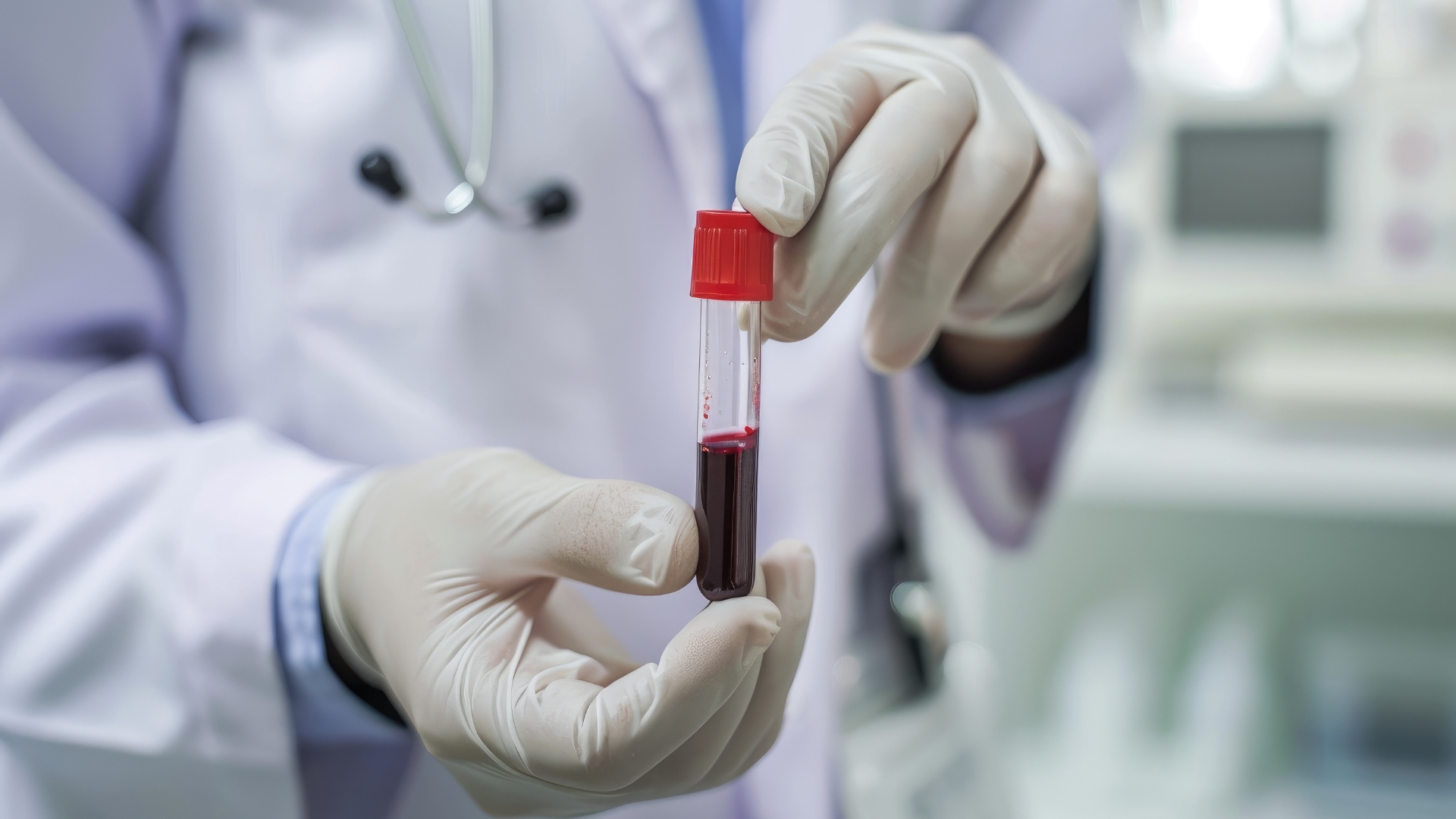 Xét nghiệm máu giúp xác định nồng độ vitamin A trong cơ thể, từ đó phát hiện tình trạng thiếu hụt