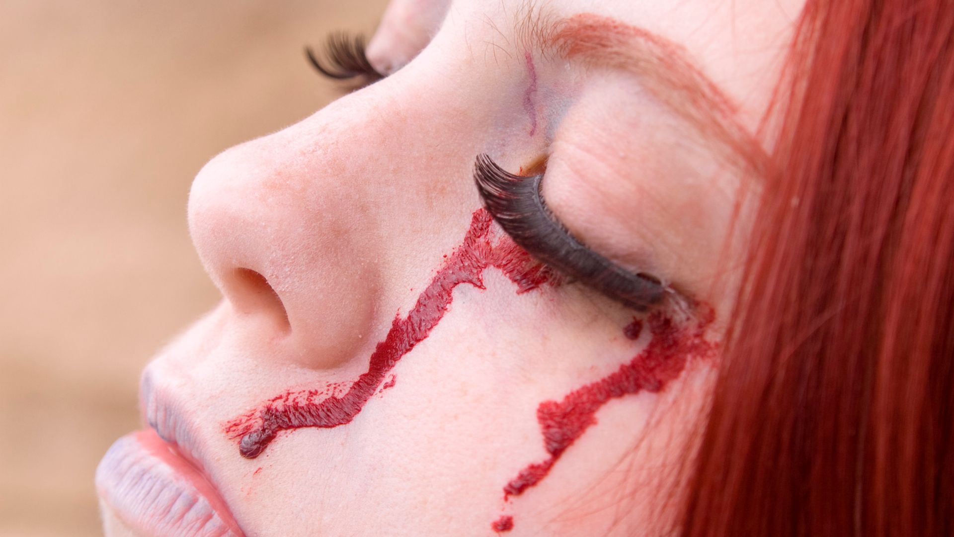 Chấn thương do vật sắc nhọn là nguyên nhân phổ biến nhất gây rách giác mạc