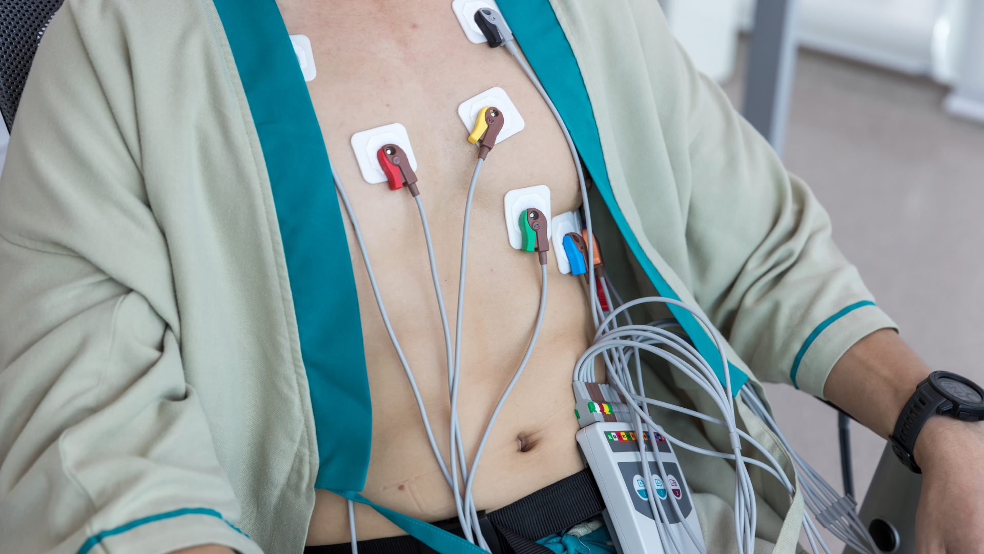 Holter điện tim có thể được chỉ định trong trường hợp rung nhĩ xuất hiện từng cơn và không ghi nhận được trên điện tâm đồ thông thường