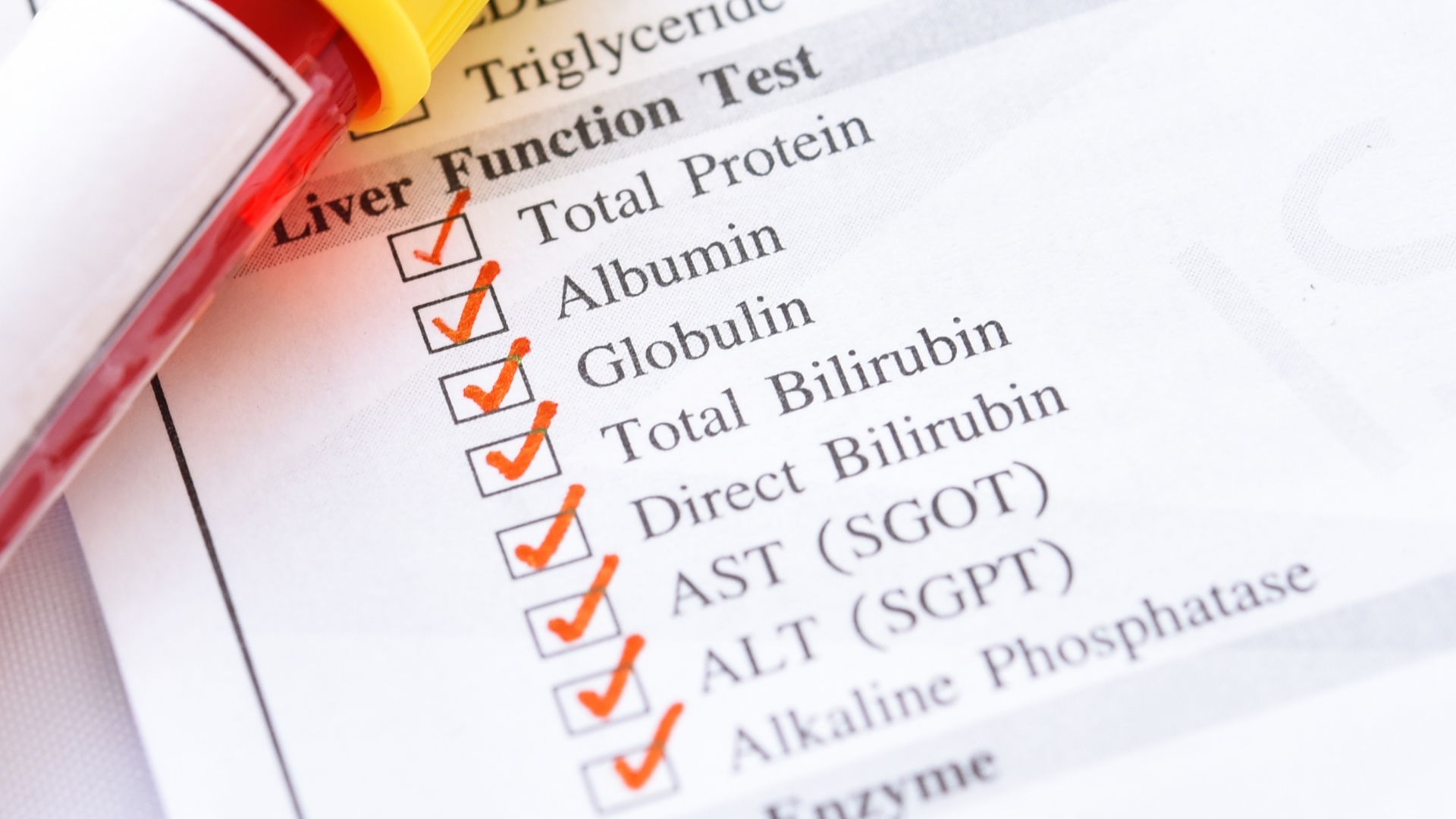 Xét nghiệm đánh giá chức năng gan là bước đầu tiên và thiết yếu trong chẩn đoán suy gan