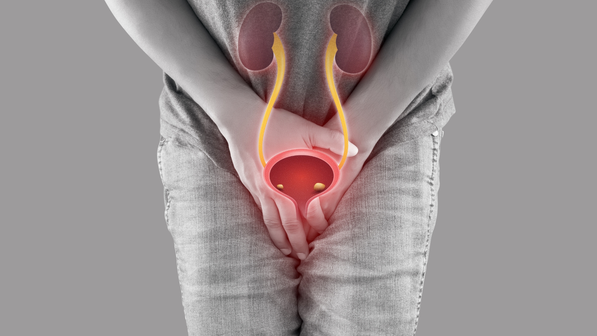 Sỏi đường tiết niệu cũng là một nguyên nhân có thể gây suy thận cấp