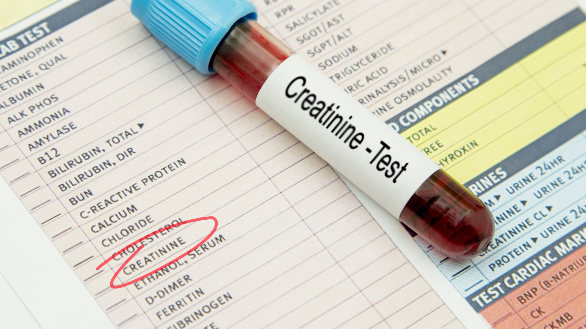 Các chỉ số như creatinin và ure sẽ được đo để xác định khả năng lọc chất thải của thận