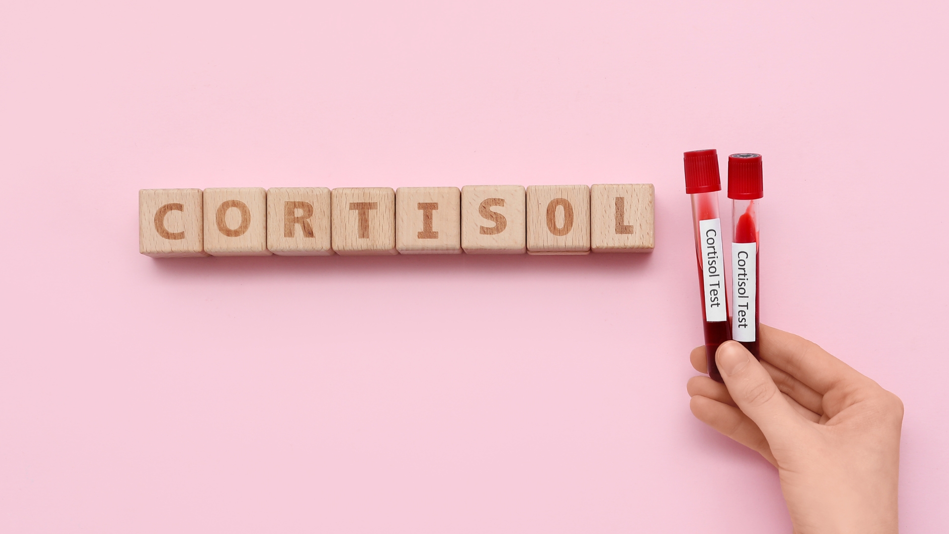 Định lượng cortisol huyết thanh là xét nghiệm nền tảng trong đánh giá chức năng tuyến thượng thận