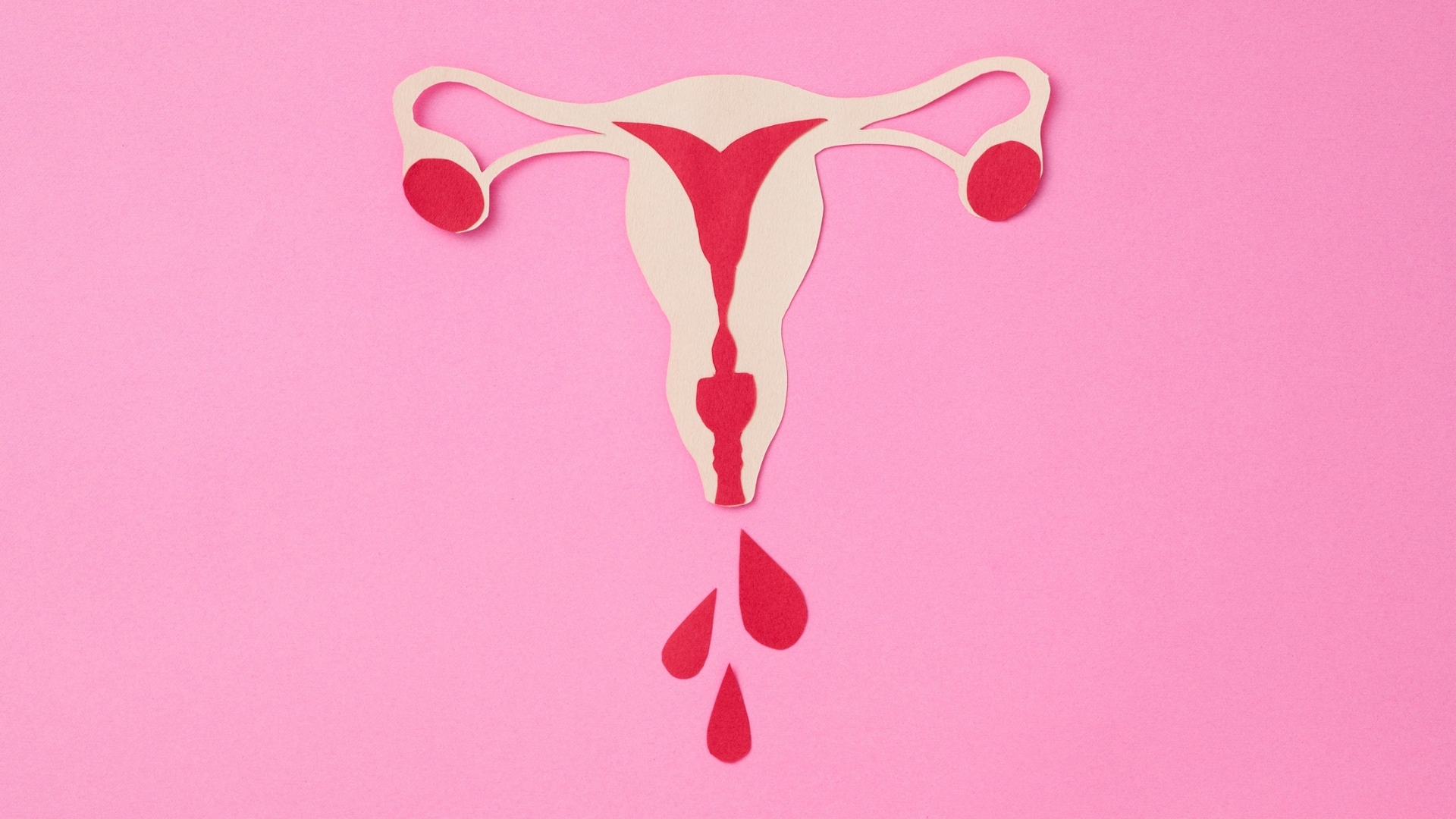 Ra huyết âm đạo bất thường là triệu chứng phổ biến nhất, thường xuất hiện vào tuần thứ 6 - 16 của thai kỳ