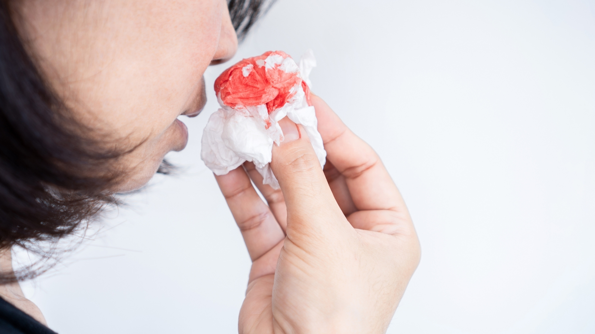 Người bị tiểu cầu thấp có thể bị chảy máu cam tái diễn