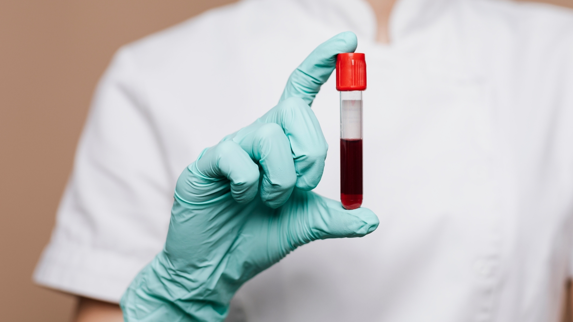 Xét nghiệm công thức máu toàn bộ giúp xác định chính xác số lượng tiểu cầu trong máu