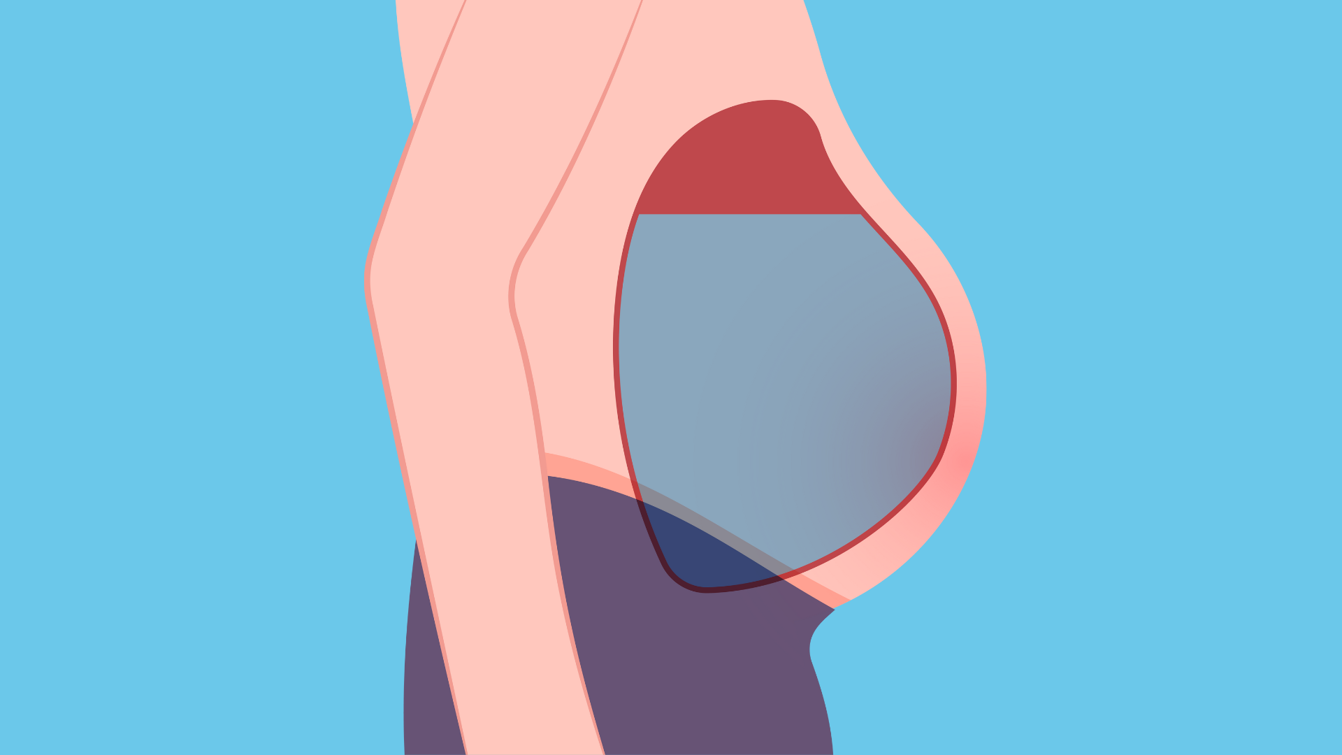 Tràn dịch màng bụng gây cảm giác đầy hơi khó tiêu