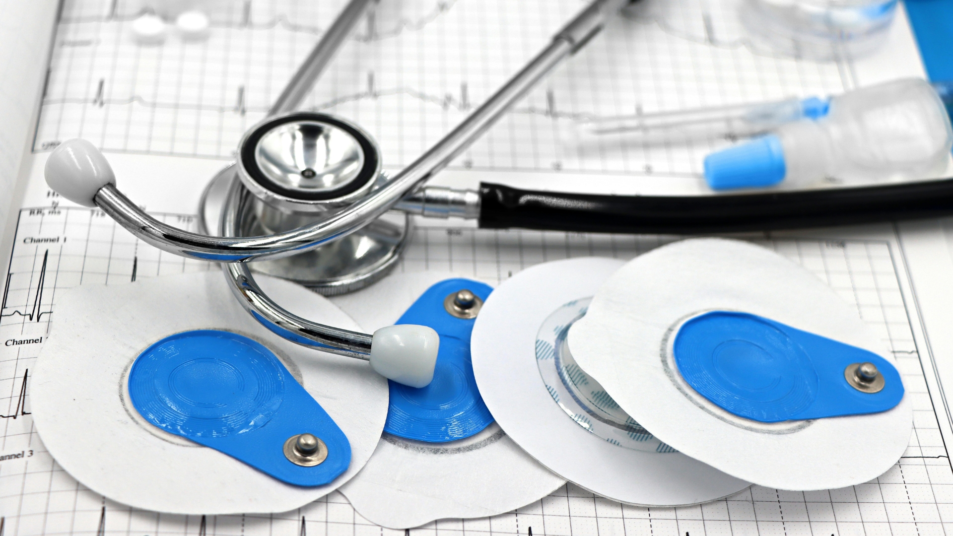 Điện tâm đồ là một xét nghiệm cơ bản và rất quan trọng trong đánh giá các bệnh lý tim mạch liên quan đến trụy tim