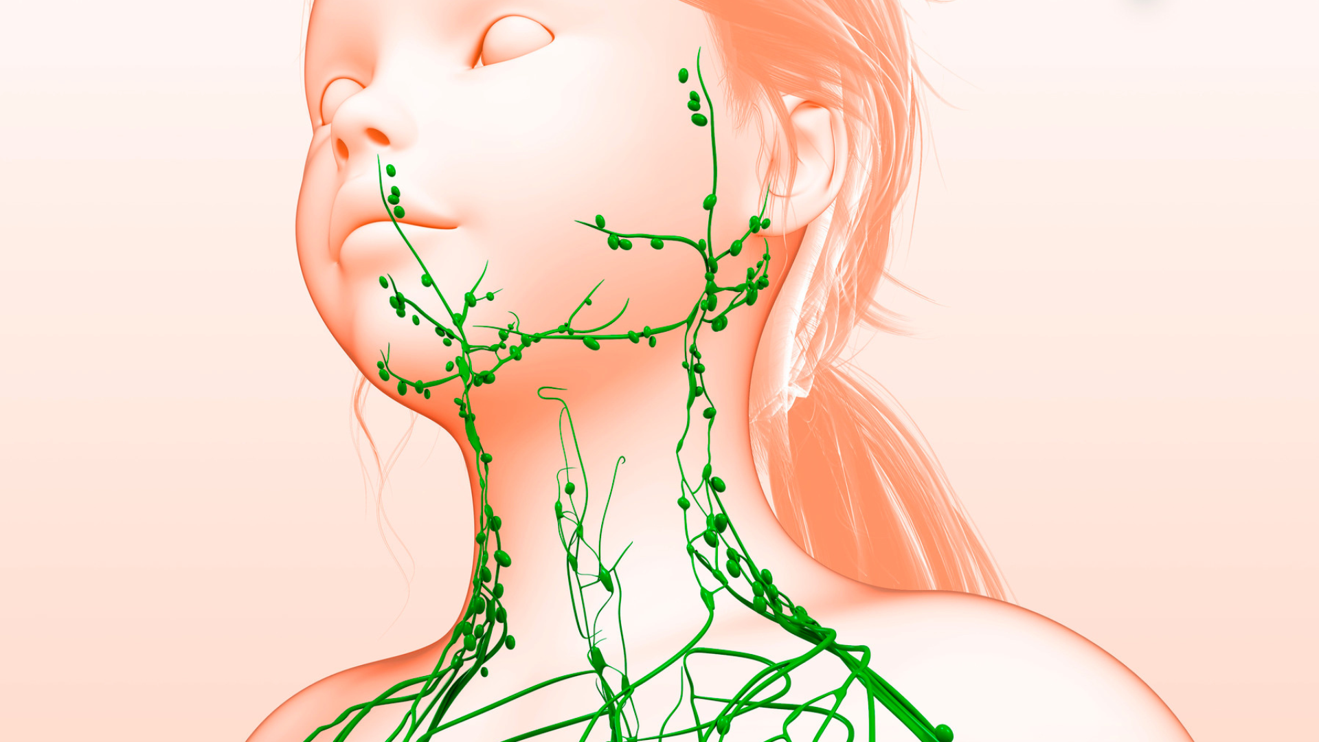 Bệnh lý mãn tính không được điều trị làm tăng nguy cơ mắc bệnh u nang bạch huyết
