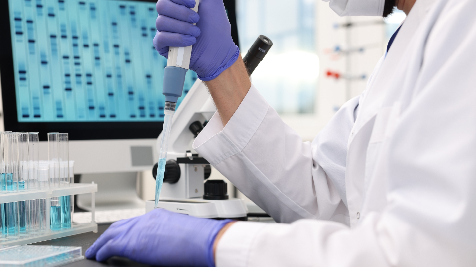 Xét nghiệm di truyền được thực hiện ở những bệnh nhân có nghi ngờ liên quan đến hội chứng di truyền hoặc có tiền sử gia đình