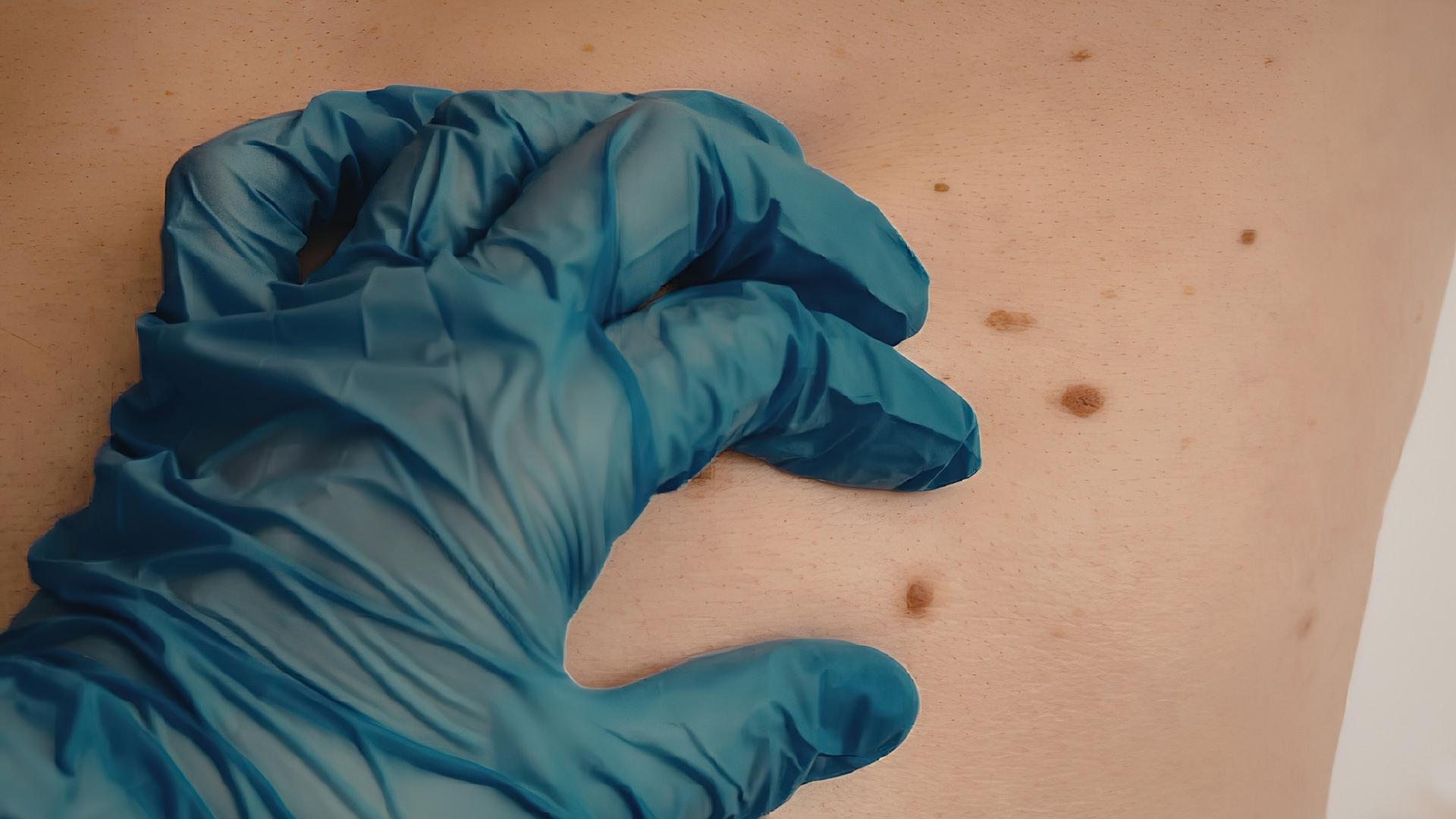 Bác sĩ tiến hành thăm khám toàn thân nhằm tìm các dấu hiệu đặc trưng