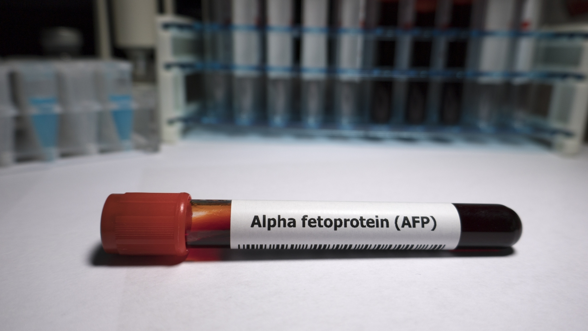 Alpha-fetoprotein (AFP) là dấu ấn sinh học thường được sử dụng trong tầm soát và hỗ trợ chẩn đoán ung thư biểu mô tế bào gan