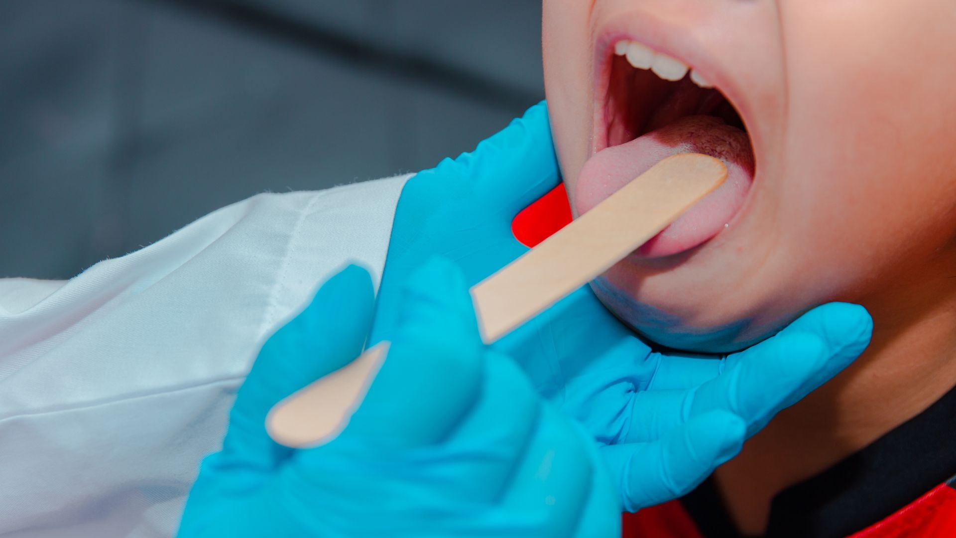 Khám lưỡi kỹ càng để phát hiện bệnh và định hướng xét nghiệm