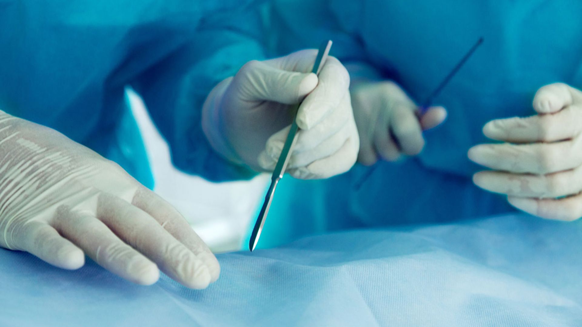 Tiền sử phẫu thuật vùng chậu là một trong những yếu tố nguy cơ