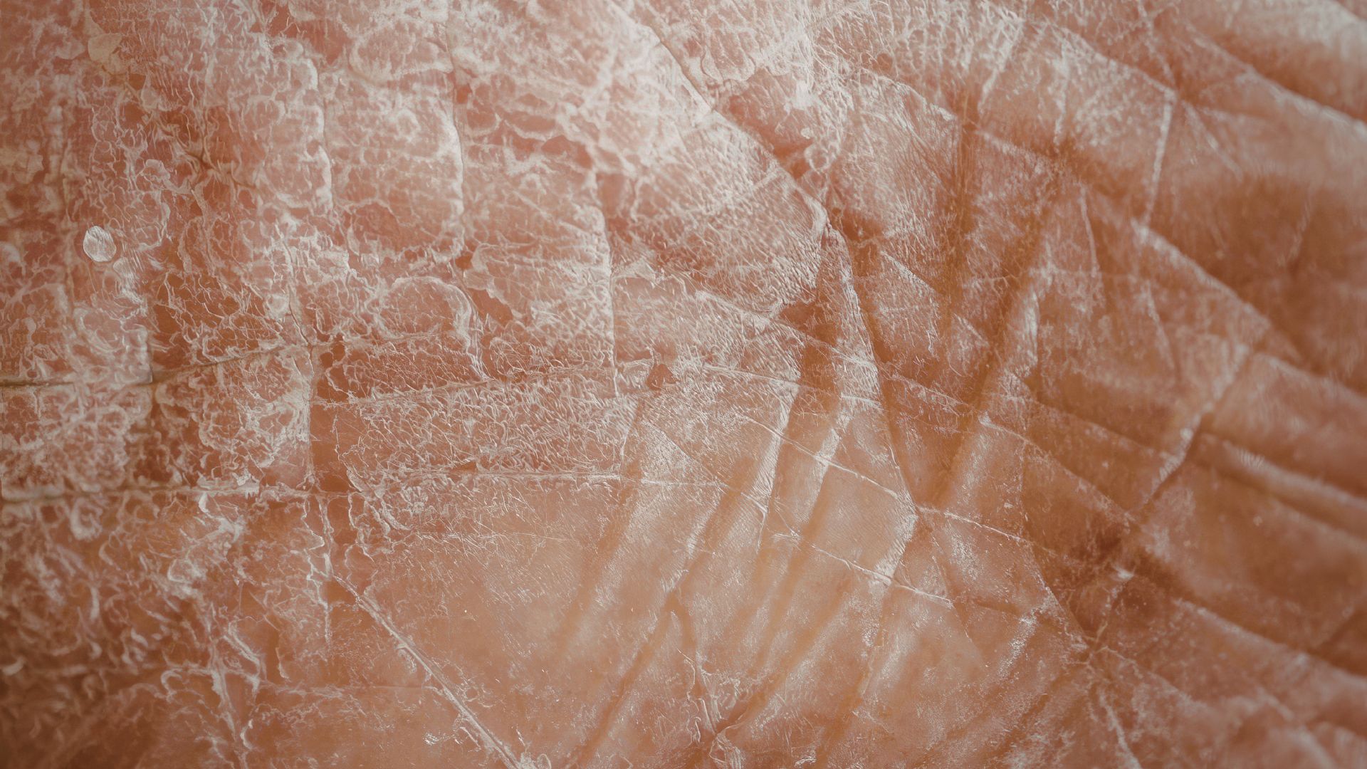 Da khô, dễ mất nước và tăng tính thấm, tạo điều kiện cho dị nguyên và vi sinh vật xâm nhập gây viêm da dị ứng