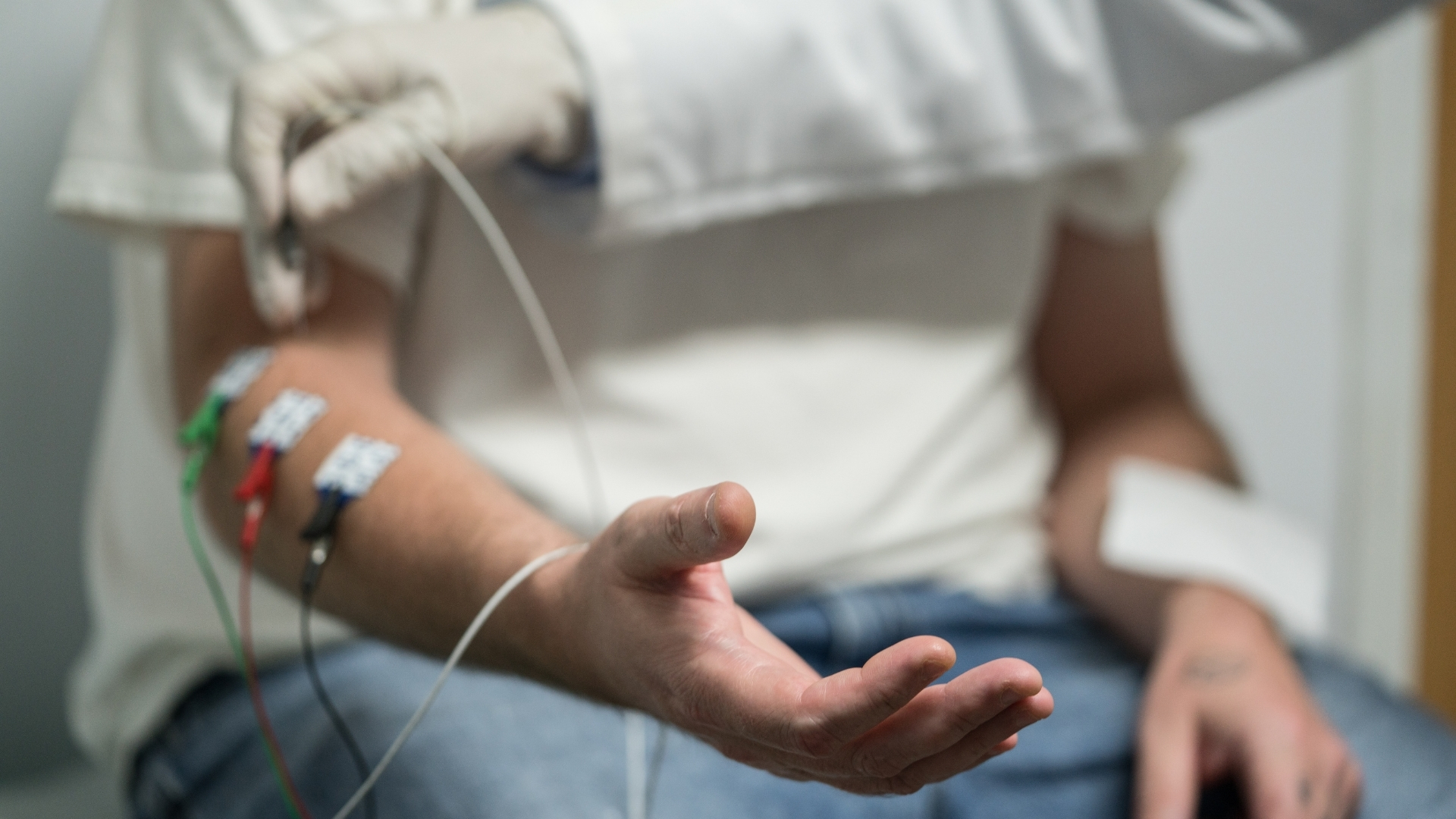 Điện cơ và đo dẫn truyền thần kinh giúp xác định chính xác mức độ và vị trí tổn thương thần kinh