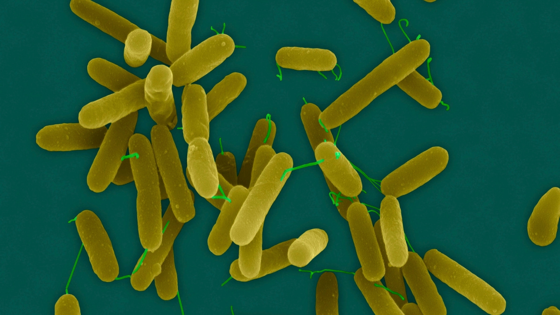 Pseudomonas aeruginosa là một nguyên nhân gây viêm giác mạc do vi khuẩn