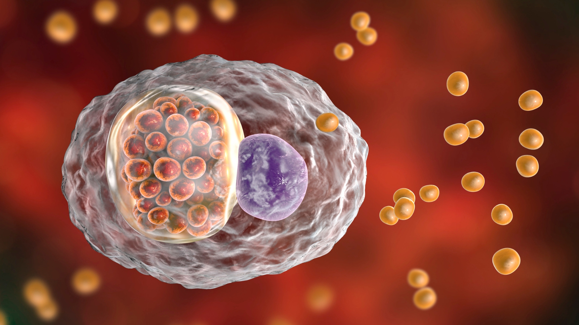 Một số trường hợp viêm khớp phản ứng xảy ra sau nhiễm Chlamydia pneumoniae