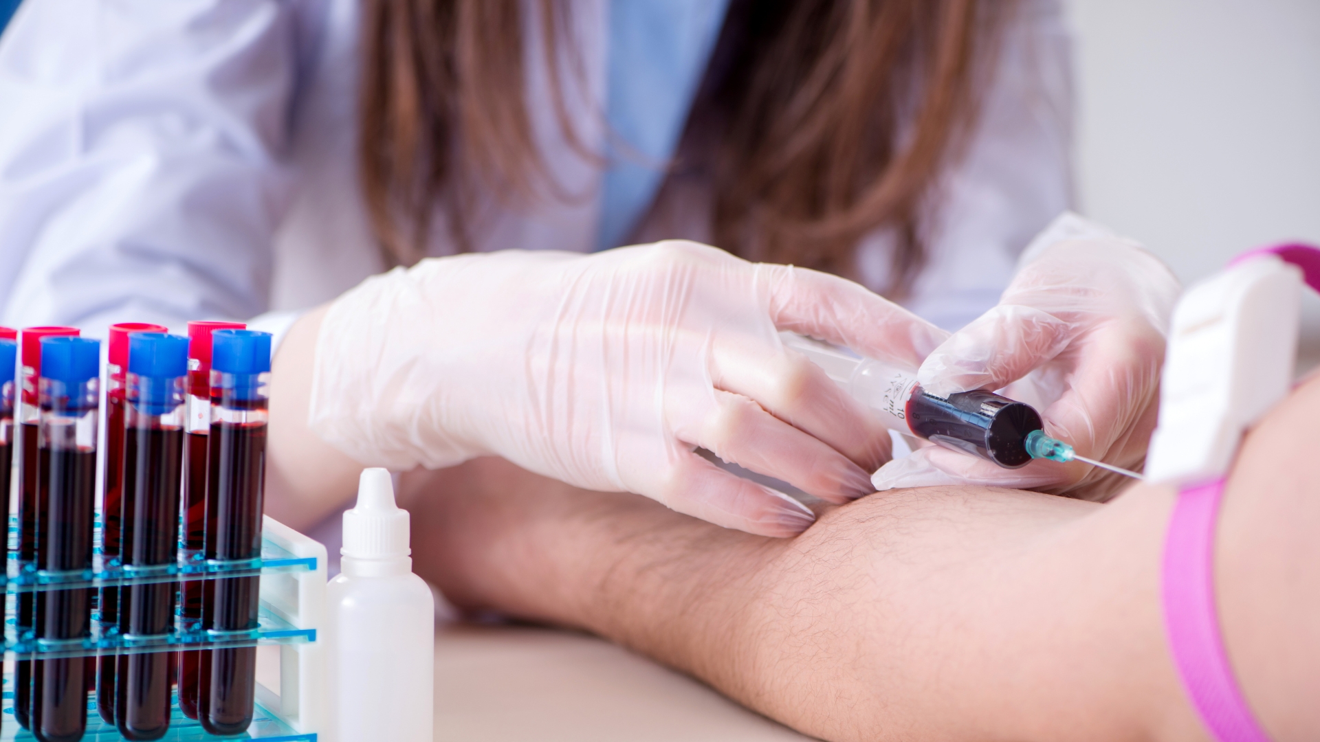 Các xét nghiệm huyết học và sinh hóa giúp đánh giá mức độ viêm và loại trừ nguyên nhân khác