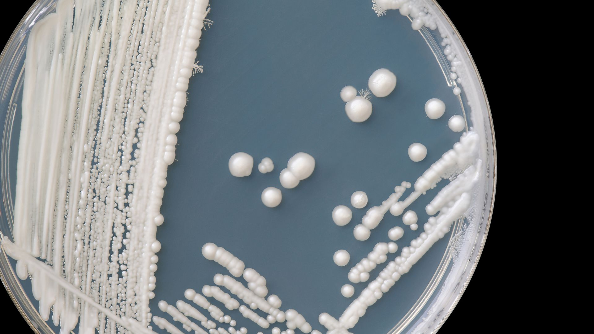 Xét nghiệm vi sinh bằng soi và nuôi cấy giúp phát hiện vi khuẩn, nấm hoặc virus gây viêm môi