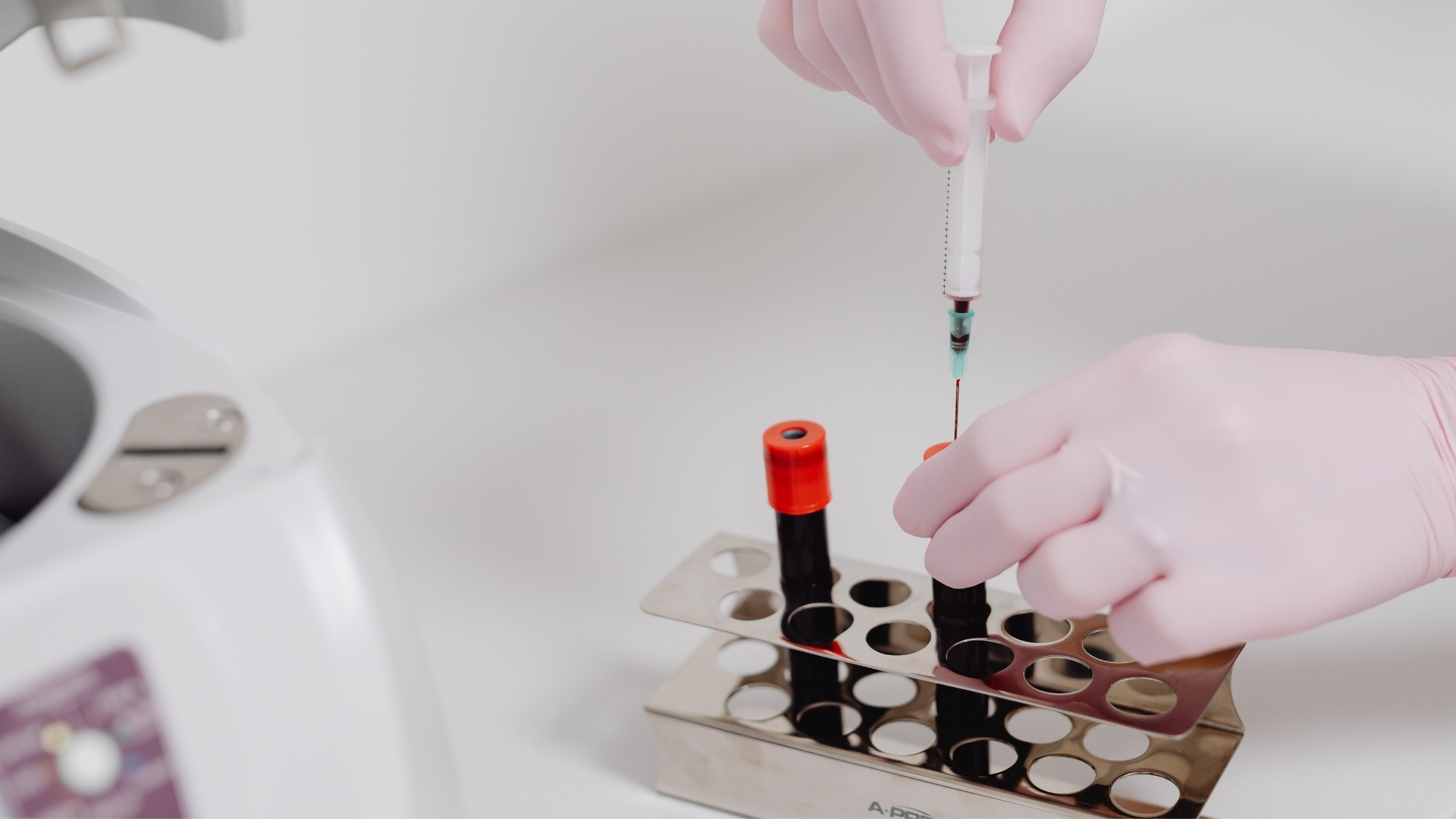 Xét nghiệm máu giúp đánh giá mức độ viêm và một số yếu tố liên quan