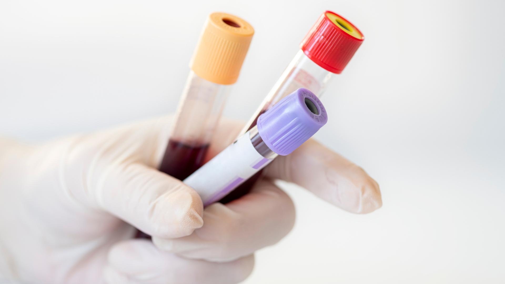 Xét nghiệm công thức máu và xét nghiệm đông máu đóng vai trò quan trọng trong việc tìm nguyên nhân nền