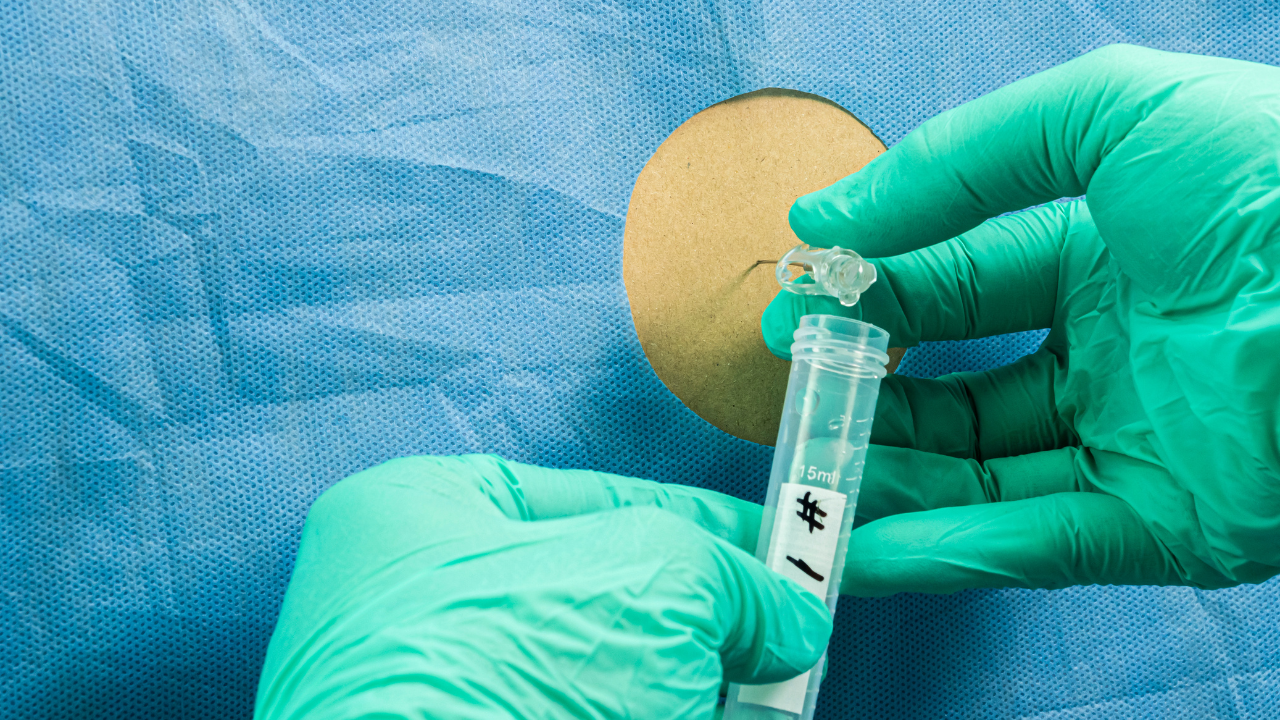 Chọc dò tủy sống lấy mẫu dịch tủy phân tích