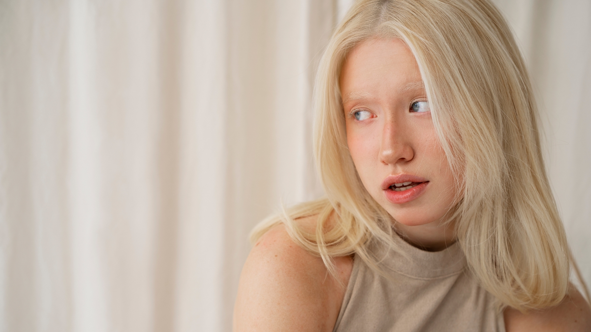 Bệnh bạch tạng có chữa được không? Câu trả lời là không thể chữa khỏi hoàn toàn