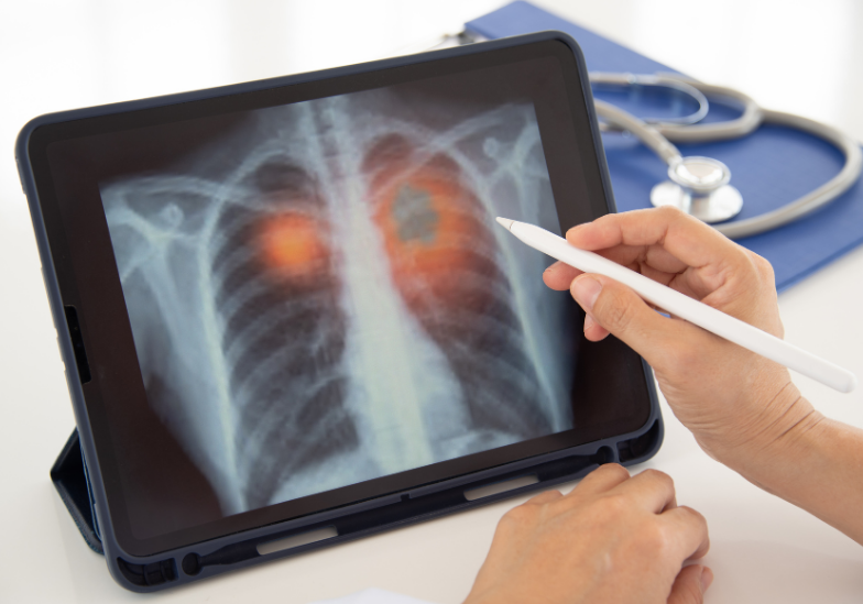 benh-cum-o-nguoi-co-benh-nen-nguy-hiem-the-nao-va-cach-phong-ngua-hieu-qua 2.png