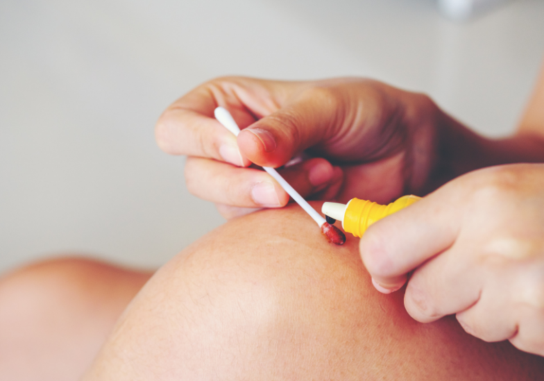 benh-dai-co-chua-duoc-khong 3.png