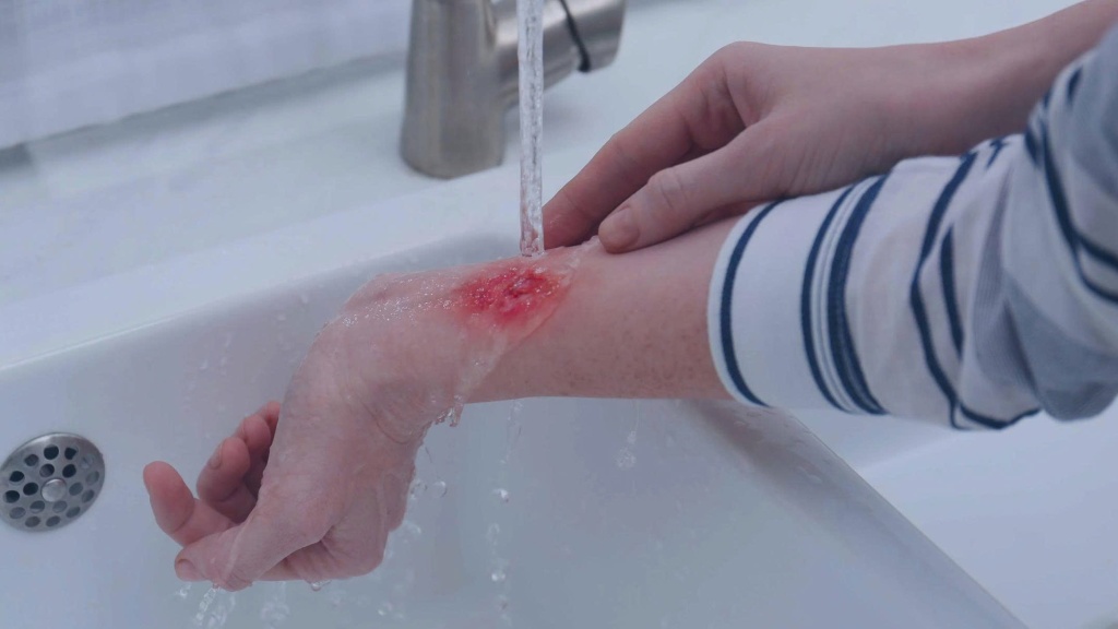 Bệnh dại mùa nắng nóng và cách phòng tránh hiệu quả 5